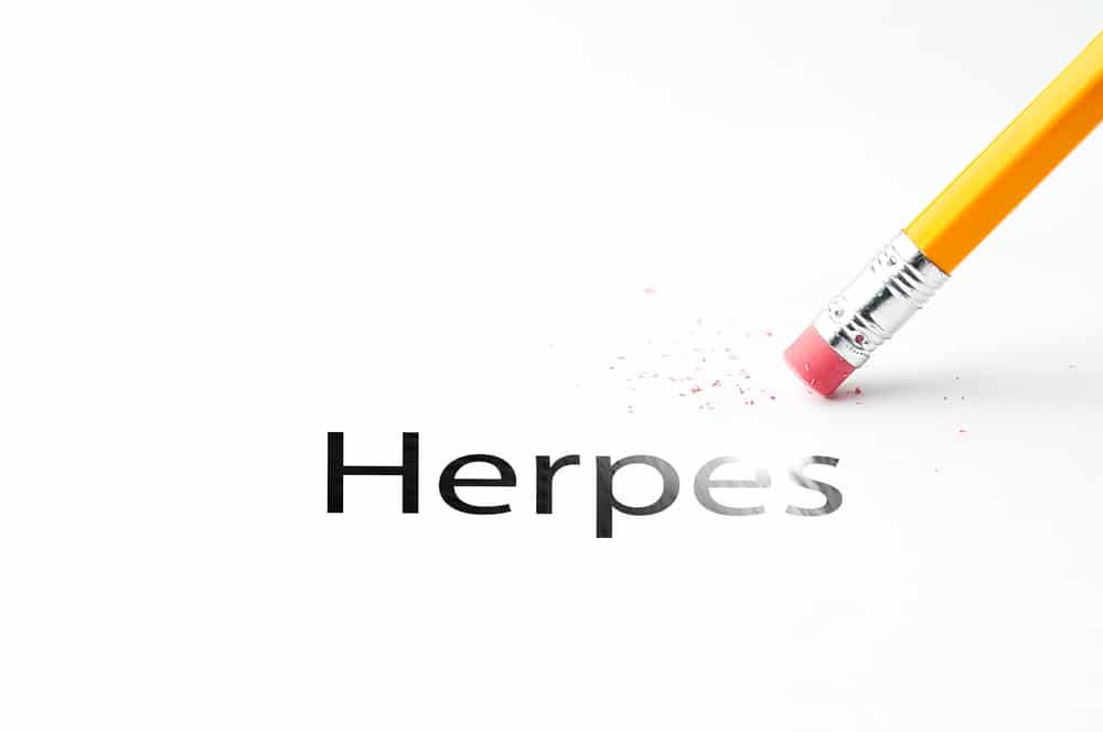 Herpes Simplex